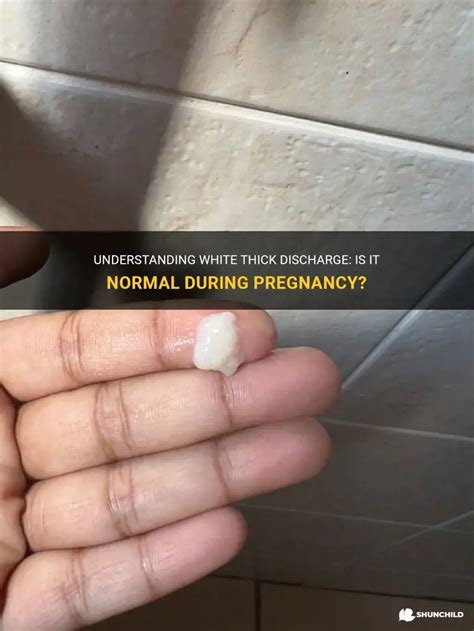 thick white discharge normal range